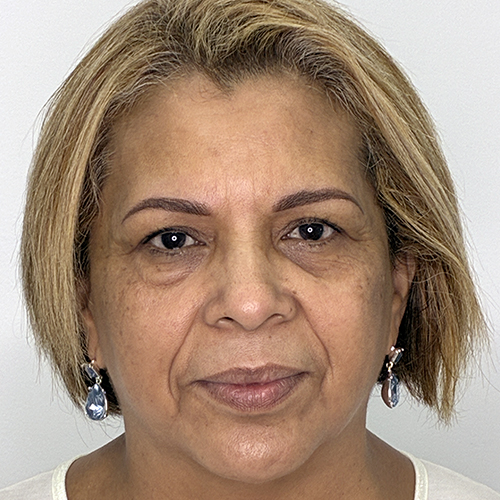 celles_despres cejas