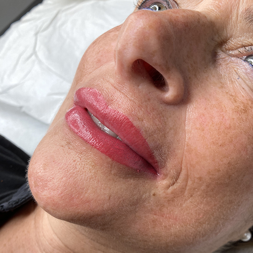 labios_despues labios