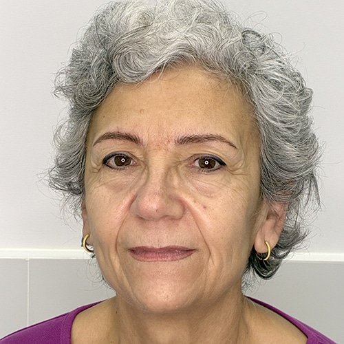 celles_pel500 cejas después