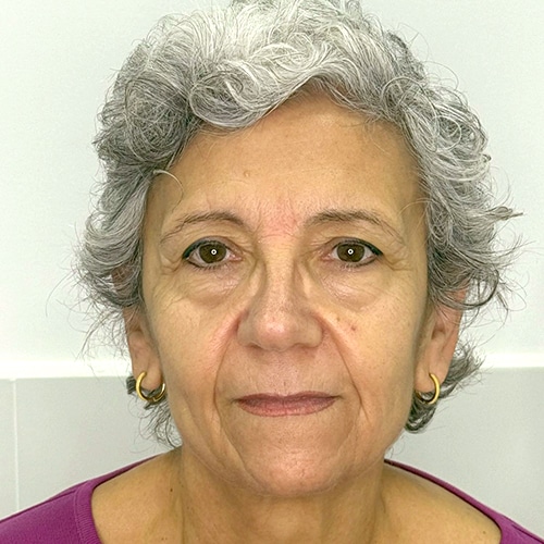 celles_pel_abans500 cejas antes