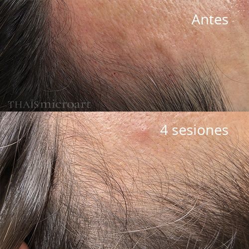 Entrades Regenx