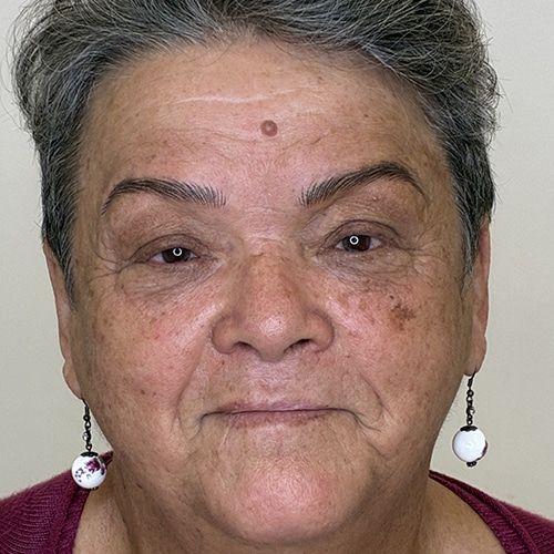 Cejas